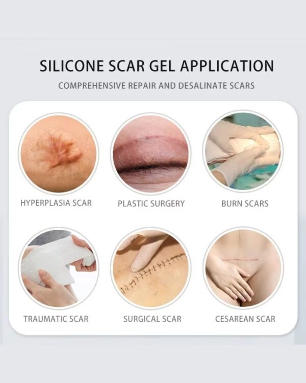 Advanced Scar Gel Applications