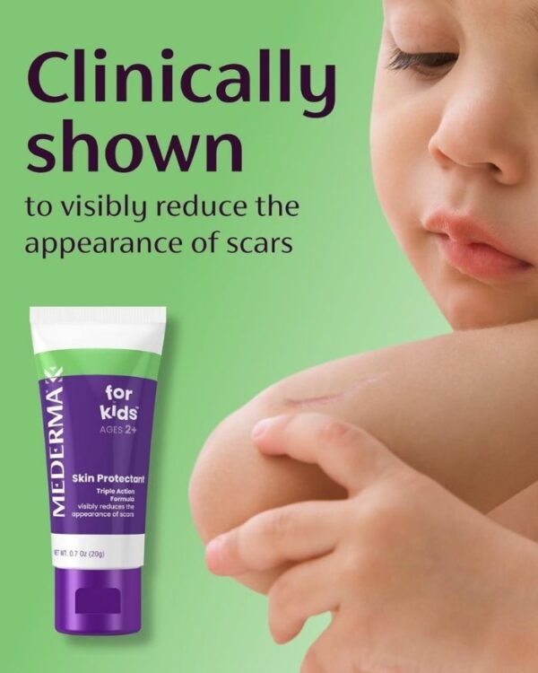 Scar Gel for Kids Facts