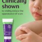 Scar Gel for Kids Facts