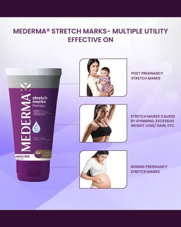 Stretch Marks Therapy Benefits