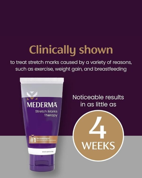 Stretch Marks Therapy Fact